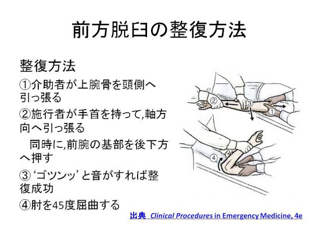 格闘技界の憧れ桜庭和志も受傷した 肘脱臼について
